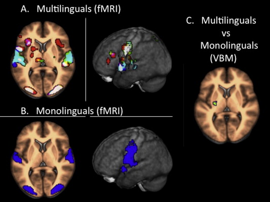 Imágenes por resonancia magnética funcional de cerebros monolingües versus multilingües