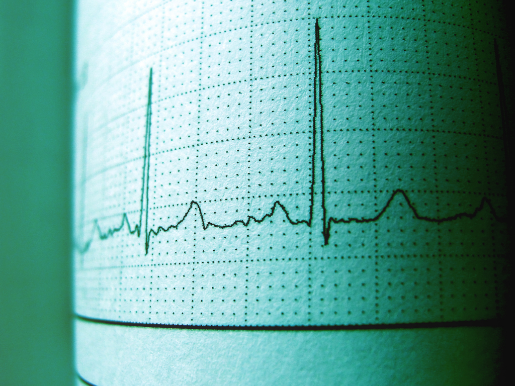 Heart rhythm ECG paramedic cardiology